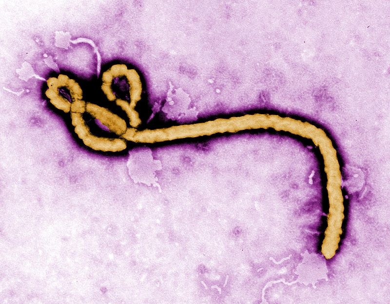 Ebola_virus_(2)