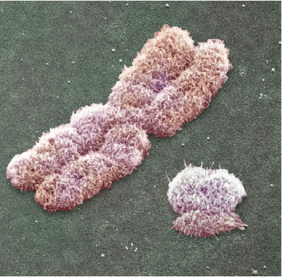 cromosoma x (izquierda) cormosoma y (derecha)